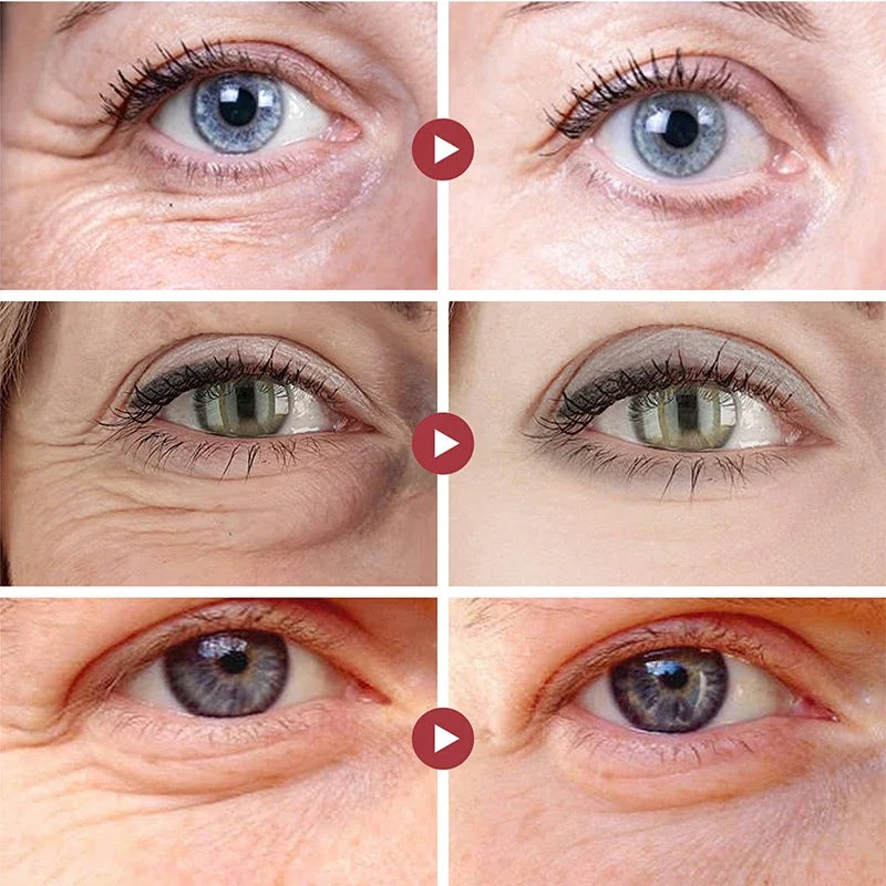 Retinol anti rugas para olheiras Eye Stick - clareador de manchas e olheiras