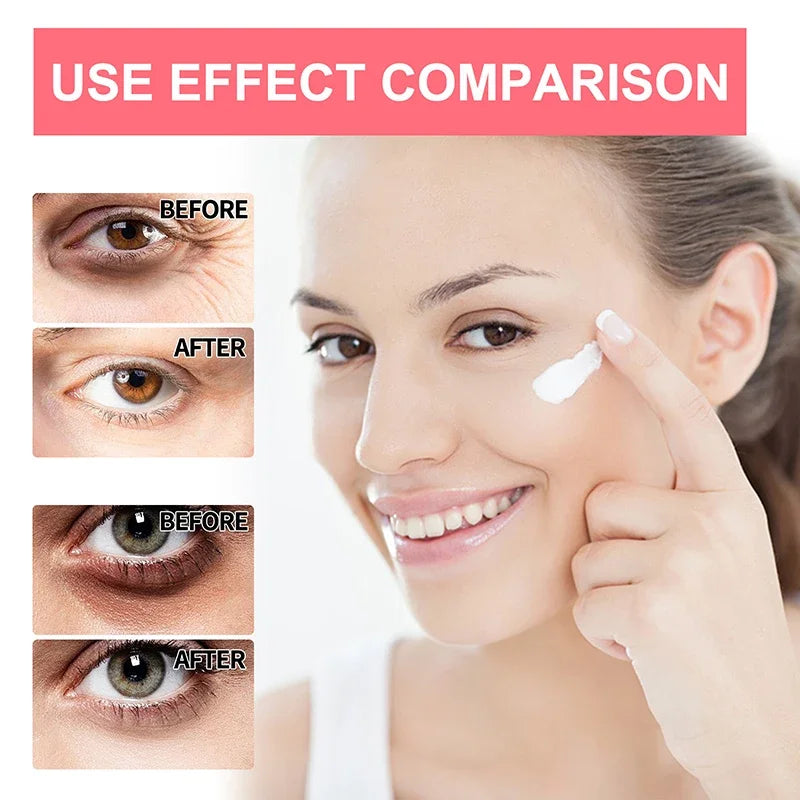 Retinol anti rugas para olheiras Eye Stick - clareador de manchas e olheiras